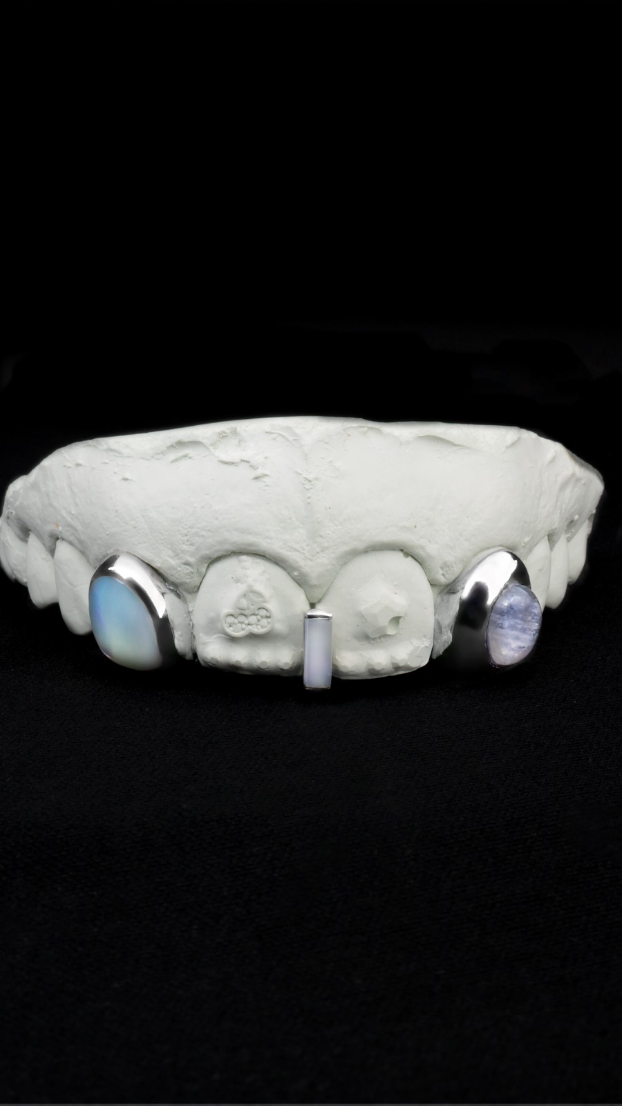 Diamond Gold Grillz